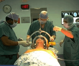Stimularea Cerebrala Profunda SCP DBS